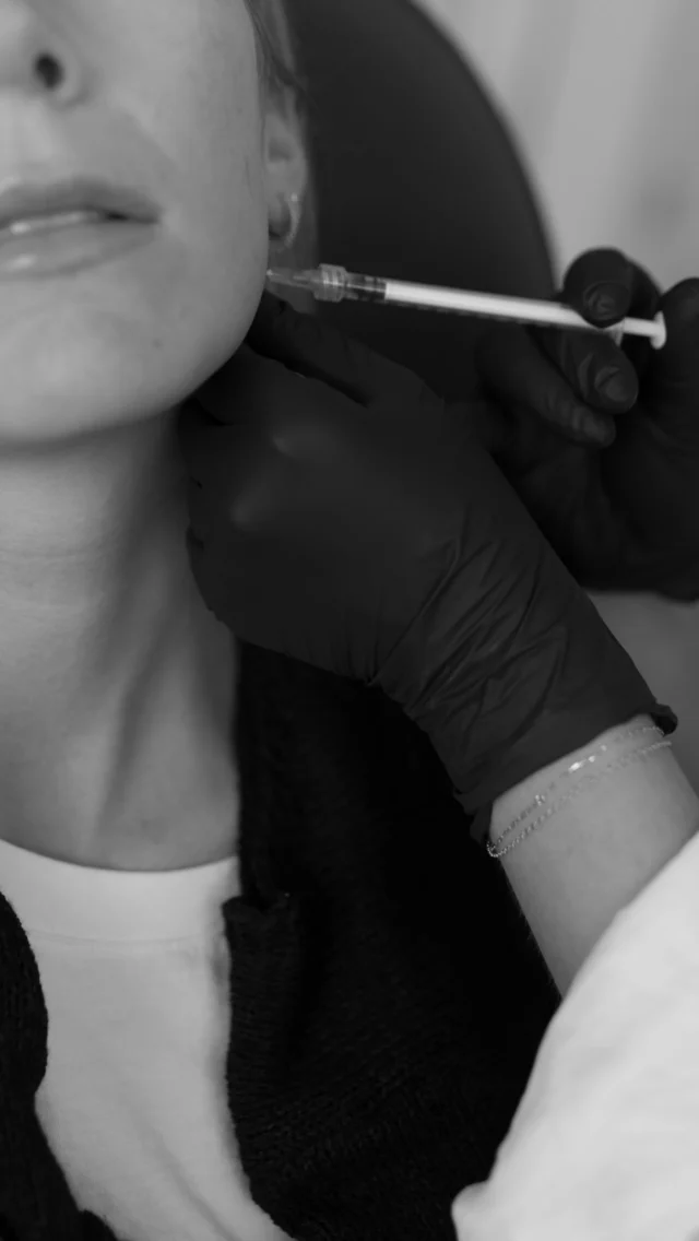 Good Botox should be hard to spot.  When approached conservatively and strategically, Botox softens lines while still allowing natural movement and expression.  The goal is not to look different. It’s to look more rested, refreshed, and aligned with how you already feel.  At CC Plastics & Skin, every treatment plan is customized with balance and restraint in mind.  Refined, not frozen.