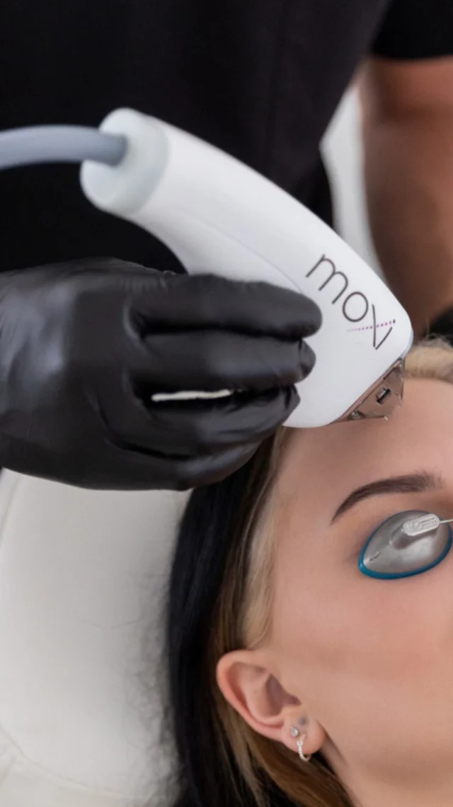The only trauma a girl needs in her life. 🤍  Moxi is a gentle fractionated laser treatment designed to improve skin tone, texture, pigmentation, and overall skin quality with minimal downtime.  Think of it as a refresh for your skin, helping support brighter, healthier-looking skin while stimulating collagen production over time.  A little laser. A lot of glow.