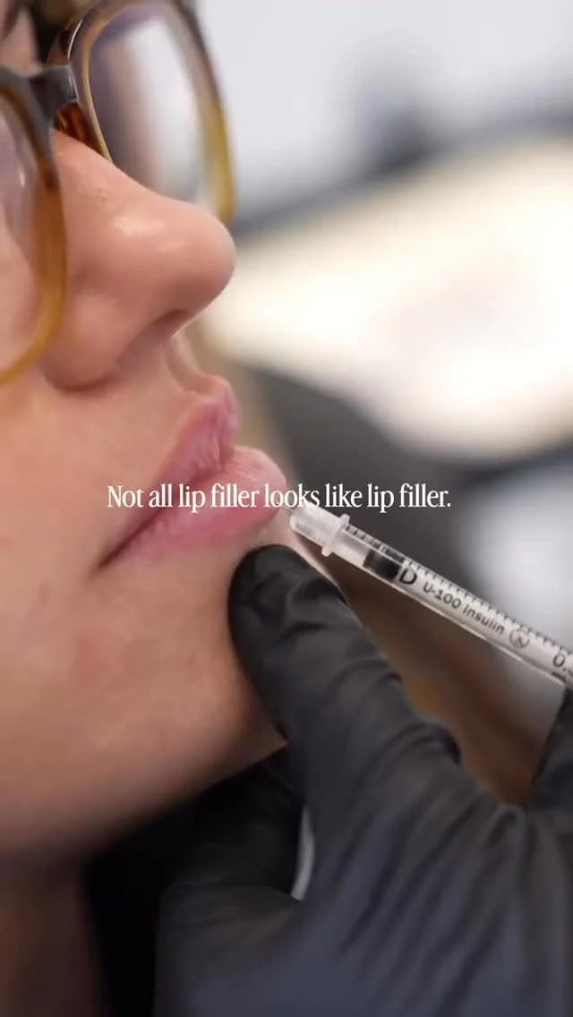 One of the reasons lip filler gets such a bad reputation is because people only notice the bad examples.  Nobody stops you in Target and says,
"Her filler looks incredibly natural."  The treatments that blend seamlessly into someone's features rarely get noticed at all.  Most of the time, patients aren't looking for a dramatic change. They're looking for subtle improvements that help them feel a little more confident when they catch their reflection, smile for a photo, or leave the house without overthinking it.  The best results tend to speak quietly.