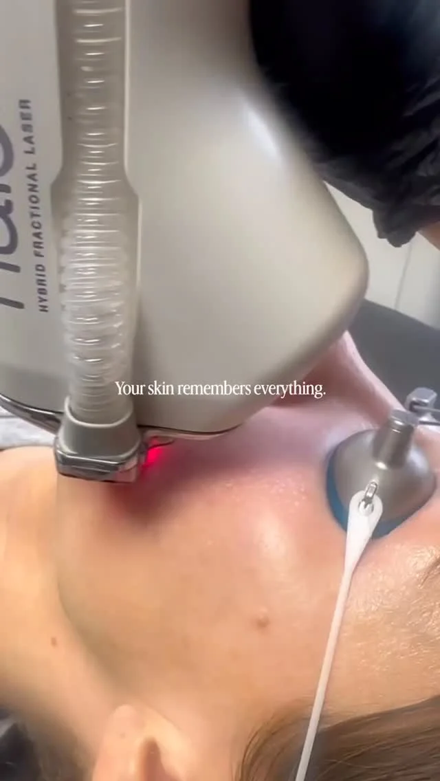 Skin aging rarely comes from one summer, one vacation, or one bad habit. It's usually the result of small things adding up over time.  Sun exposure accumulates. Collagen loss accumulates. Environmental damage accumulates.  The good news is that healthy habits work the same way.  Consistent SPF, quality skincare, and treatments that support skin health can all contribute to healthier skin over the long term.  That's why many skin quality treatments aren't designed to create a dramatic overnight change. They're designed to improve the condition of the skin gradually and help support it for years to come.